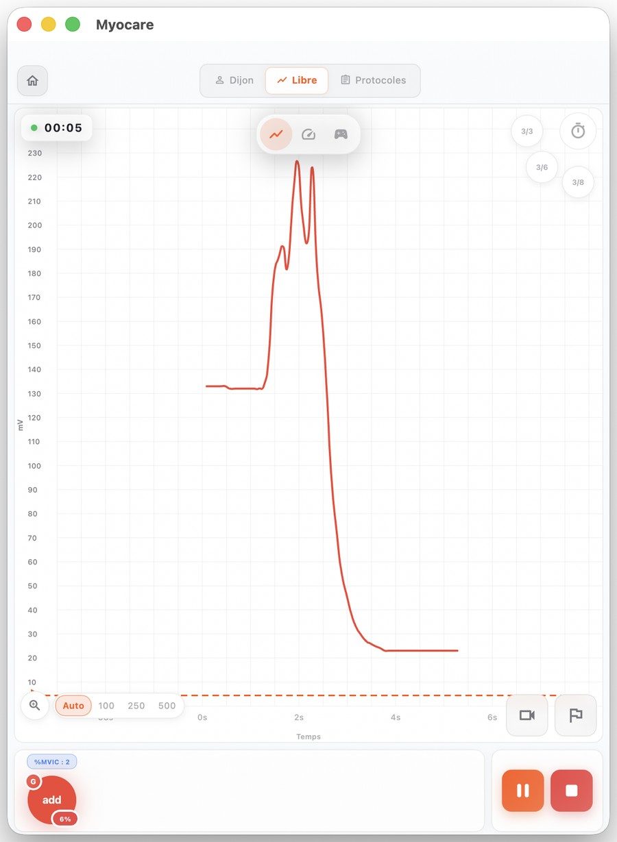Séance : biofeedback EMG en temps réel