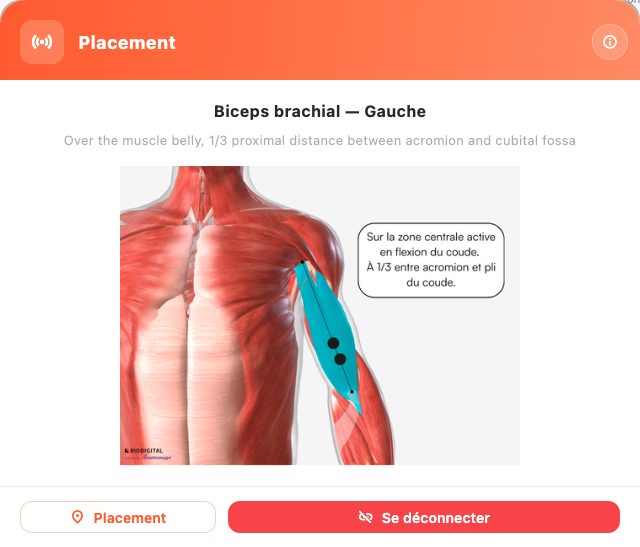 Guide de placement affiché par l'application (biceps brachial gauche)