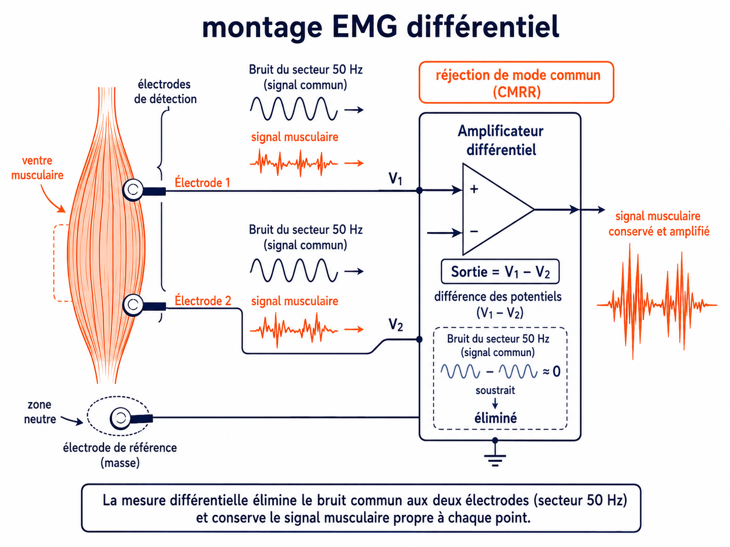 Montage EMG différentiel : deux électrodes sur le ventre musculaire reliées à l'amplificateur différentiel