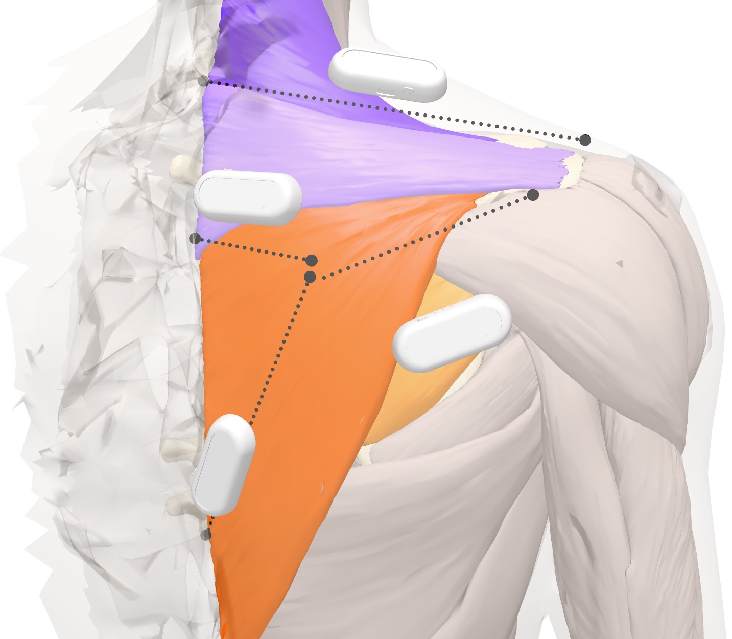 Placement des capteurs Myocell vu de dos, sur un modèle anatomique 3D : trapèze supérieur et trapèze moyen en violet, trapèze inférieur et sous-épineux en orange, avec les lignes entre repères osseux