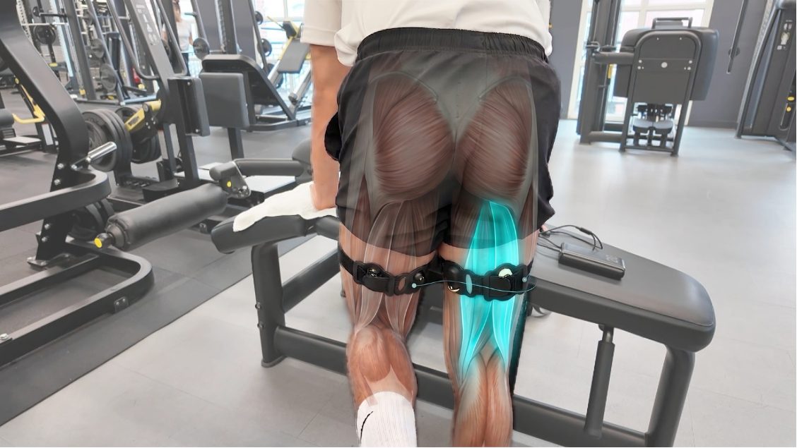 Capteurs posés sur la face postérieure des cuisses, muscles en surimpression : biceps fémoral en latéral, ischios médiaux surlignés en médial, un capteur strappé sur chaque site