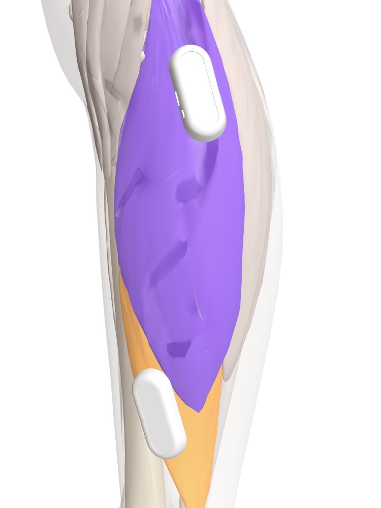 Capteurs Myocell sur le gastrocnémien médial et le soléaire de la jambe droite, vue postéro-médiale sur le modèle anatomique 3D