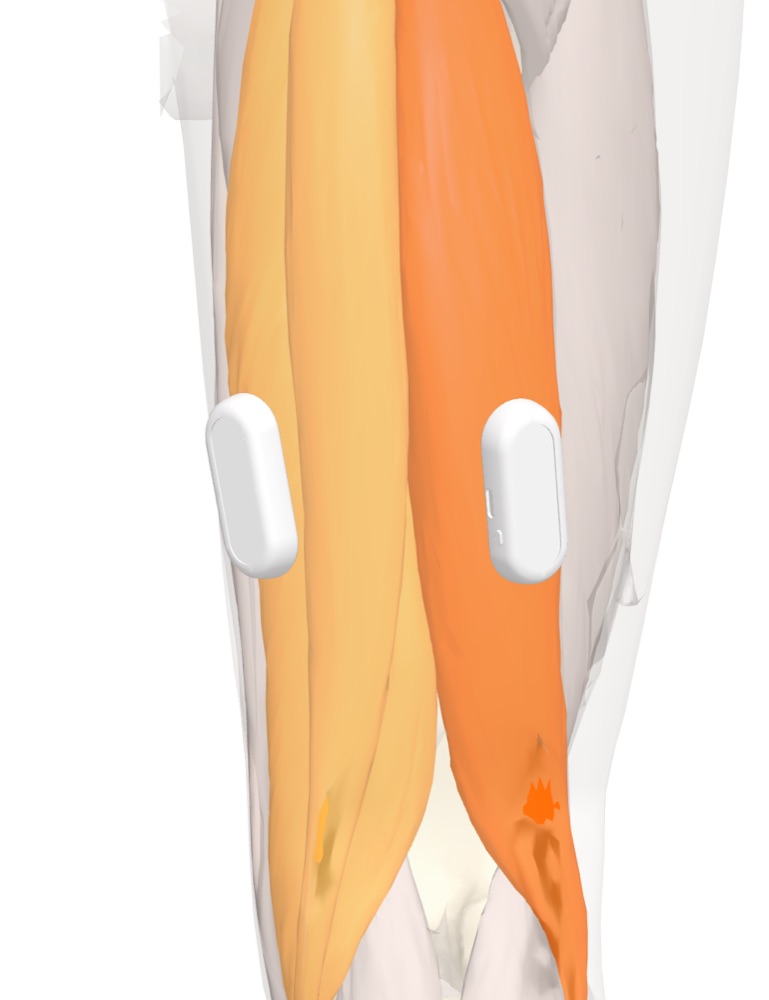 Capteurs Myocell sur le semi-tendineux et le biceps fémoral de la cuisse droite, vue de dos sur le modèle anatomique 3D